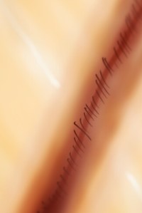 Scar - Copyright © http://atomic-temporary-30814180.wpcomstaging.com